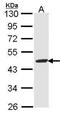 Fumarylacetoacetate Hydrolase antibody, GTX102583, GeneTex, Western Blot image 