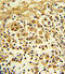 Enolase 1 antibody, 62-302, ProSci, Immunohistochemistry paraffin image 