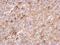 Plasminogen Activator, Urokinase antibody, GTX100465, GeneTex, Immunohistochemistry paraffin image 