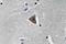 Rho Associated Coiled-Coil Containing Protein Kinase 1 antibody, LS-C177597, Lifespan Biosciences, Immunohistochemistry paraffin image 
