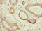 Hydroxysteroid 17-Beta Dehydrogenase 12 antibody, orb355235, Biorbyt, Immunohistochemistry paraffin image 
