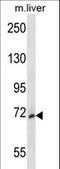 Mitogen-Activated Protein Kinase Kinase Kinase 3 antibody, LS-C164454, Lifespan Biosciences, Western Blot image 