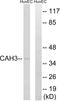 Carbonic Anhydrase 3 antibody, A30591, Boster Biological Technology, Western Blot image 