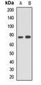 Acyl-CoA Synthetase Long Chain Family Member 5 antibody, LS-C668322, Lifespan Biosciences, Western Blot image 