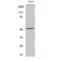 Tryptophan Hydroxylase 1 antibody, LS-C386474, Lifespan Biosciences, Western Blot image 