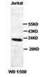 Upstream Transcription Factor 1 antibody, orb77442, Biorbyt, Western Blot image 