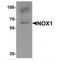 NADPH Oxidase 1 antibody, TA349080, Origene, Western Blot image 