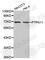 Protein Tyrosine Phosphatase Non-Receptor Type 11 antibody, A2793, ABclonal Technology, Western Blot image 