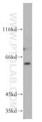 P21 (RAC1) Activated Kinase 1 antibody, 51137-1-AP, Proteintech Group, Western Blot image 