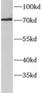 Acyl-CoA Synthetase Short Chain Family Member 3 antibody, FNab00114, FineTest, Western Blot image 