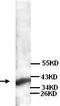 Neutrophil Cytosolic Factor 1 antibody, TA310072, Origene, Western Blot image 