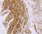 Desmin antibody, 13-827, ProSci, Immunohistochemistry paraffin image 