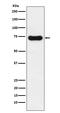 Interleukin 1 Receptor Associated Kinase 2 antibody, M01559-1, Boster Biological Technology, Western Blot image 