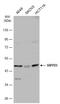 SET And MYND Domain Containing 3 antibody, NBP2-20430, Novus Biologicals, Western Blot image 