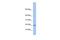 Norrin Cystine Knot Growth Factor NDP antibody, PA5-44481, Invitrogen Antibodies, Western Blot image 