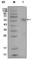 Estrogen Receptor 1 antibody, abx016079, Abbexa, Western Blot image 
