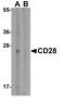 CD28 antibody, A00065, Boster Biological Technology, Western Blot image 