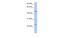 Transmembrane And Coiled-Coil Domain Family 1 antibody, MBS838932, MyBioSource, Western Blot image 