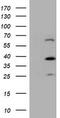 Dystrobrevin Beta antibody, TA504325, Origene, Western Blot image 