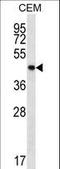 PTPN2 antibody, LS-C158768, Lifespan Biosciences, Western Blot image 