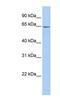 Arylsulfatase E antibody, NBP1-62667, Novus Biologicals, Western Blot image 