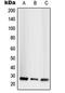 TNF Superfamily Member 13 antibody, orb214825, Biorbyt, Western Blot image 