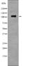 EPH Receptor B1 antibody, abx215189, Abbexa, Western Blot image 