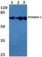 BRF1 RNA Polymerase III Transcription Initiation Factor Subunit antibody, PA5-36344, Invitrogen Antibodies, Western Blot image 