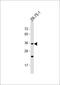 Olfactory Receptor Family 2 Subfamily L Member 8 (Gene/Pseudogene) antibody, 59-346, ProSci, Western Blot image 