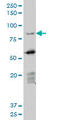 Deleted In Azoospermia 1 antibody, LS-C133147, Lifespan Biosciences, Western Blot image 