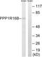 Protein Phosphatase 1 Regulatory Subunit 16B antibody, LS-C120259, Lifespan Biosciences, Western Blot image 