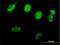 RAD51 Recombinase antibody, H00005888-B01P, Novus Biologicals, Immunocytochemistry image 