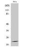 Ribosomal Protein L17 antibody, STJ95463, St John