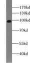 Transient Receptor Potential Cation Channel Subfamily M Member 5 antibody, FNab09021, FineTest, Western Blot image 
