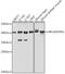 Hypoxia Inducible Factor 1 Subunit Alpha Inhibitor antibody, GTX32652, GeneTex, Western Blot image 