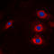 HECT, C2 And WW Domain Containing E3 Ubiquitin Protein Ligase 2 antibody, GTX56038, GeneTex, Immunocytochemistry image 