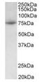 Protein Arginine Methyltransferase 7 antibody, orb12297, Biorbyt, Western Blot image 