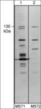 Transient Receptor Potential Cation Channel Subfamily M Member 8 antibody, TM5721, ECM Biosciences, Western Blot image 