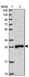 TPD52 Like 2 antibody, PA5-61532, Invitrogen Antibodies, Western Blot image 