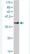 TXK Tyrosine Kinase antibody, H00007294-M03, Novus Biologicals, Western Blot image 