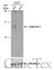 Galectin 1 antibody, GTX116411, GeneTex, Western Blot image 