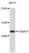 S100 Calcium Binding Protein A16 antibody, abx126506, Abbexa, Western Blot image 