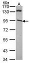 CDKN1A Interacting Zinc Finger Protein 1 antibody, NBP2-15906, Novus Biologicals, Western Blot image 