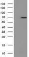 EPM2A Interacting Protein 1 antibody, MA5-25256, Invitrogen Antibodies, Western Blot image 