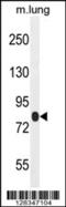 Tetratricopeptide Repeat Domain 30B antibody, 55-581, ProSci, Western Blot image 