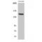 Misshapen Like Kinase 1 antibody, LS-C384542, Lifespan Biosciences, Western Blot image 