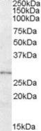 Lysophospholipase Like 1 antibody, PA5-18904, Invitrogen Antibodies, Western Blot image 