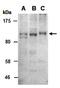 Acid Phosphatase, Prostate antibody, orb66897, Biorbyt, Western Blot image 