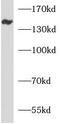 Ankyrin Repeat Domain 50 antibody, FNab00415, FineTest, Western Blot image 