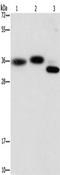 CAPZA2 antibody, TA349742, Origene, Western Blot image 